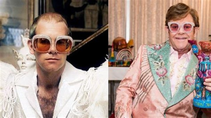 Has Elton John Done Plastic Surgery? Fans Curious About Botox And Facelift!
