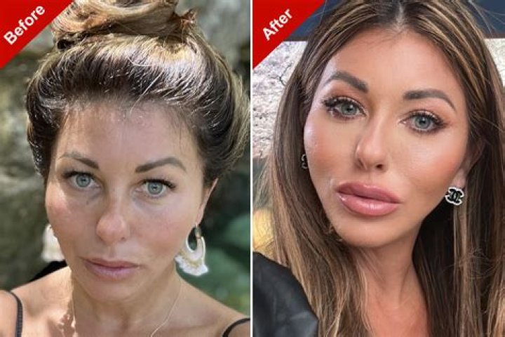 Michelle Dee No Makeup Look: Plastic Surgery Before And After