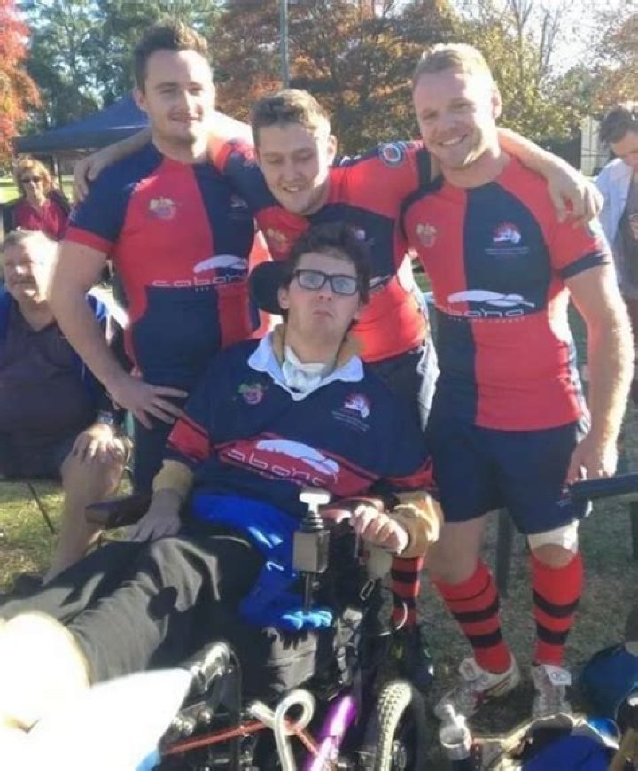 
What Happened To Sam Ballard? Rugby Player Death From An Illness 